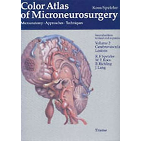 UPC: 9783131111029 | Color Atlas of Microneurosurgery: Volume 2 – Cerebrovascular Lesions: Microanatomy – Approaches – Techniques (Hardcover)