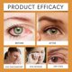 thumbnail image 3 of Honey Eye Relief Drops For Dry Tired Eyes, Provides Long-Lasting Moisture Promotes Overall Eye Health, Eyes Care Product, 3 of 5