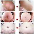 thumbnail image 2 of Anti Stretch Mark Lifting Cream Scar Repair 60g, 2 of 8