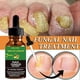 thumbnail image 2 of Nails-Care-Repair Nail-Fungal-Treatment Anti-Fungus Onychomycosis-Removal, 2 of 5