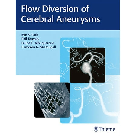 UPC: 9781626237773 | Flow Diversion of Cerebral Aneurysms (Hardcover)