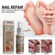 thumbnail image 1 of Spray reparador de uñas grises Elimina las uñas grises Tratamiento para uñas Tratamiento nutritivo para uñas Bright Nail | 8042665686184, 1 of 5