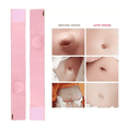 thumbnail image 3 of 2 Pcs Cinturones De Hernia Tratamiento Umbilical Para Bebé Lab.G, Rosa, 3 of 5