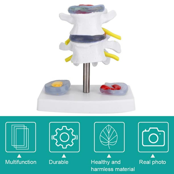 Modelo de Vértebras Lumbares Humanas, Modelo de Esqueleto Anatómico Humano Modelo de VéRtebras Lumbares con Base Extraíble Fácil de Instalar Ayuda a las Personas a Controlar el Estado de la Columna Ecomeon no