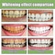 thumbnail image 2 of 10/20/30pcs Ampoule Toothpaste, Ampoule Tooth Serum, Ampoule Essence Toothpast, 2 of 5