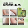 thumbnail image 3 of 1-3x Cyperus oil Rotundus for hair removal - natural Cyperus oil reducing the growth of body hair, moisturizing and soothing, 3 of 5