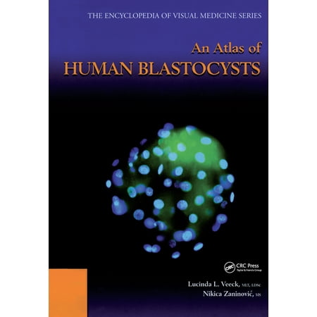 UPC: 9781842141694 | Encyclopedia of Visual Medicine Series: An Atlas of Human Blastocysts (Hardcover)