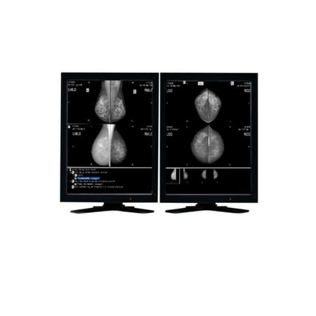 Pair (x2) Eizo Radiforce GS521 5MP Grayscale Digital Mammography Diagnostic Monitors