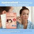 thumbnail image 3 of MEDca Universal Pimple Acne Patch Absorbing Cover 2 Sizes, All Skin type - 36 Pack, 3 of 9