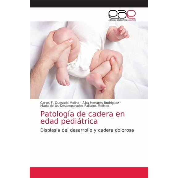 Patología de cadera en edad pediátrica (Paperback)