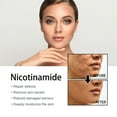 Nicotinamide Face Serum Dark Spot Whitening Acne Pimple Treatment Pore ...