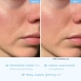 thumbnail image 5 of KAMEDIS Champú Terapéutico Anticaspa. Para el cuero cabelludo sensible y escamoso que pica y la dermatitis seborreica. Contiene 1% de piritiona de zinc y ácido salicílico. Remedio para el cabello y la, 5 of 5