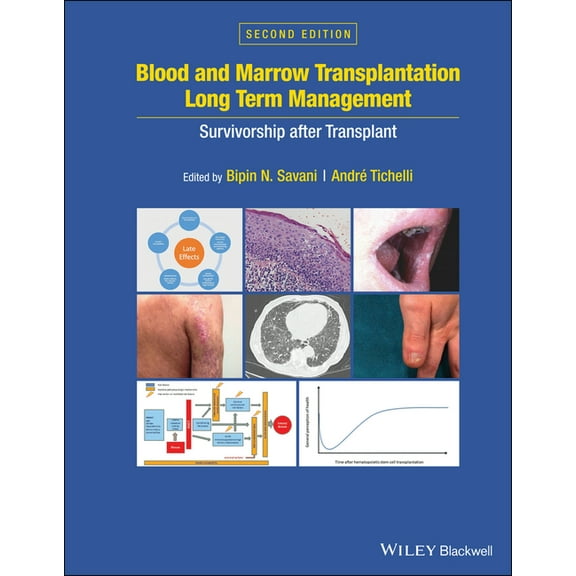 Blood and Marrow Transplantation Long Term Management: Survivorship After Transplant (Hardcover)