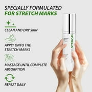 Abera Ovela Stretch Mark Cream for Pregnancy, Postpartum & Weight Fluctuations, Sunflower Jojoba Oil, 1.69fl oz