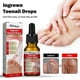 thumbnail image 2 of 10ML Ingrown Toenail Treatment,nail Growth Treatment,ingrown Toenail Drops Cuticle Nail Oil Ingrown Toenail Correction, 2 of 5