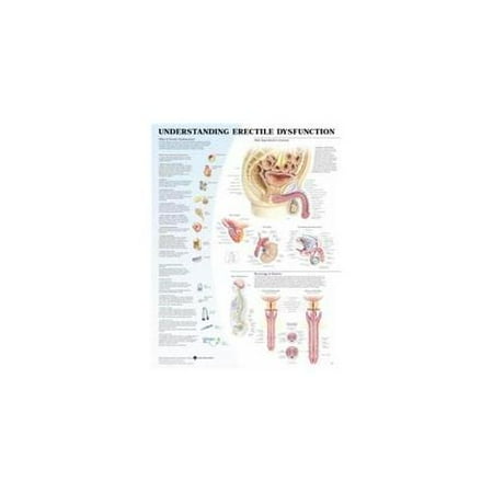 AWW 9781587795459 Understanding Erectile Dysfunction - Walmart.com