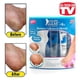 thumbnail image 3 of El kit de tratamiento de pies claros y callosos elimina los callos Hidrata suavemente la piel lisa y saludable del pie como se ve en la televisión Pedegg Powerball 6902, 3 of 4
