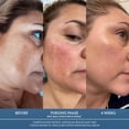 thumbnail image 6 of Admire My Skin Facial Dark Spot Serum , Lightweight Skin Brightening Serum for Uneven Skin Tone – 1 fl oz, 6 of 8