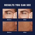 thumbnail image 4 of Crema Facial AvitaPure 6 en 1 para Hombre Anti-Edad 100 ml, 4 of 8