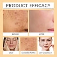 thumbnail image 4 of Gel de Extracto de Aloe Hidratante Facial | Crema reparadora reafirmante de hidratación profunda después del sol | Papaya e ingredientes naturales | Elasticidad antienvejecimiento | No graso | Tarro, 4 of 7