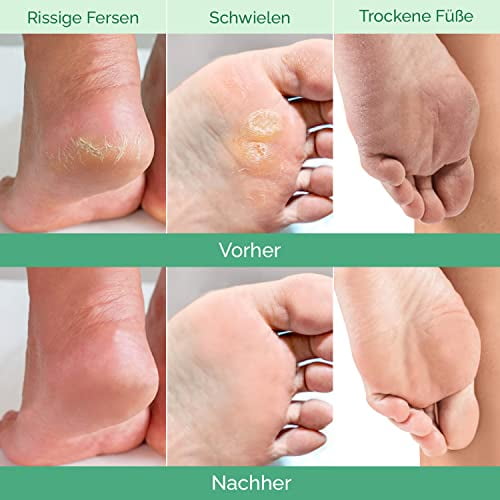 PLANTIFIQUE Foot Peel Mask with Vitamins 1 Pack Peeling Foot Mask Dermatologically Tested Repairs Heels Removes Dead Skin for Baby Soft Feet
