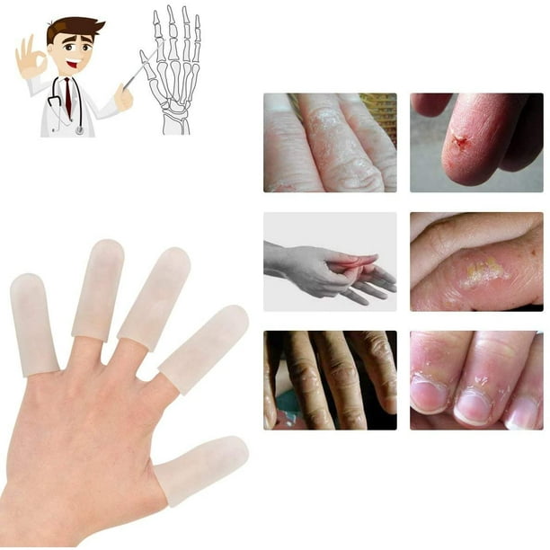 20 Pieces Gel Finger Cover, Finger Cots, Finger Protector for Women and Men, Great for Trigger Finger, Finger Cracking, Finger Arthritis, Finger - Walmart.com