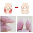 thumbnail image 4 of Ingrown Toenail Pedicure Tool 10pcs/bottle Straightening Curved Bs Brace Toenails Thick Paronychia, 4 of 5