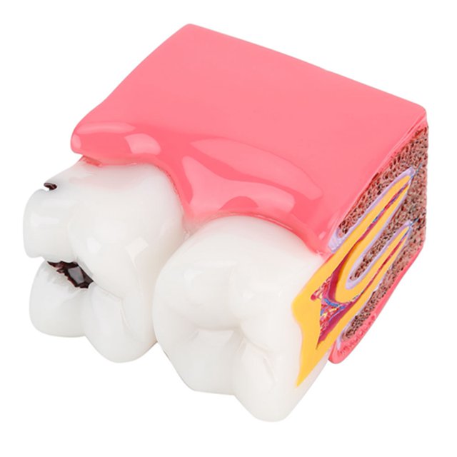 Modelo De Dientes, Modelo De Anatomía Dental Portátil Compacto De Resina Para El Cuidado Bucal Para Laboratorio Dental
