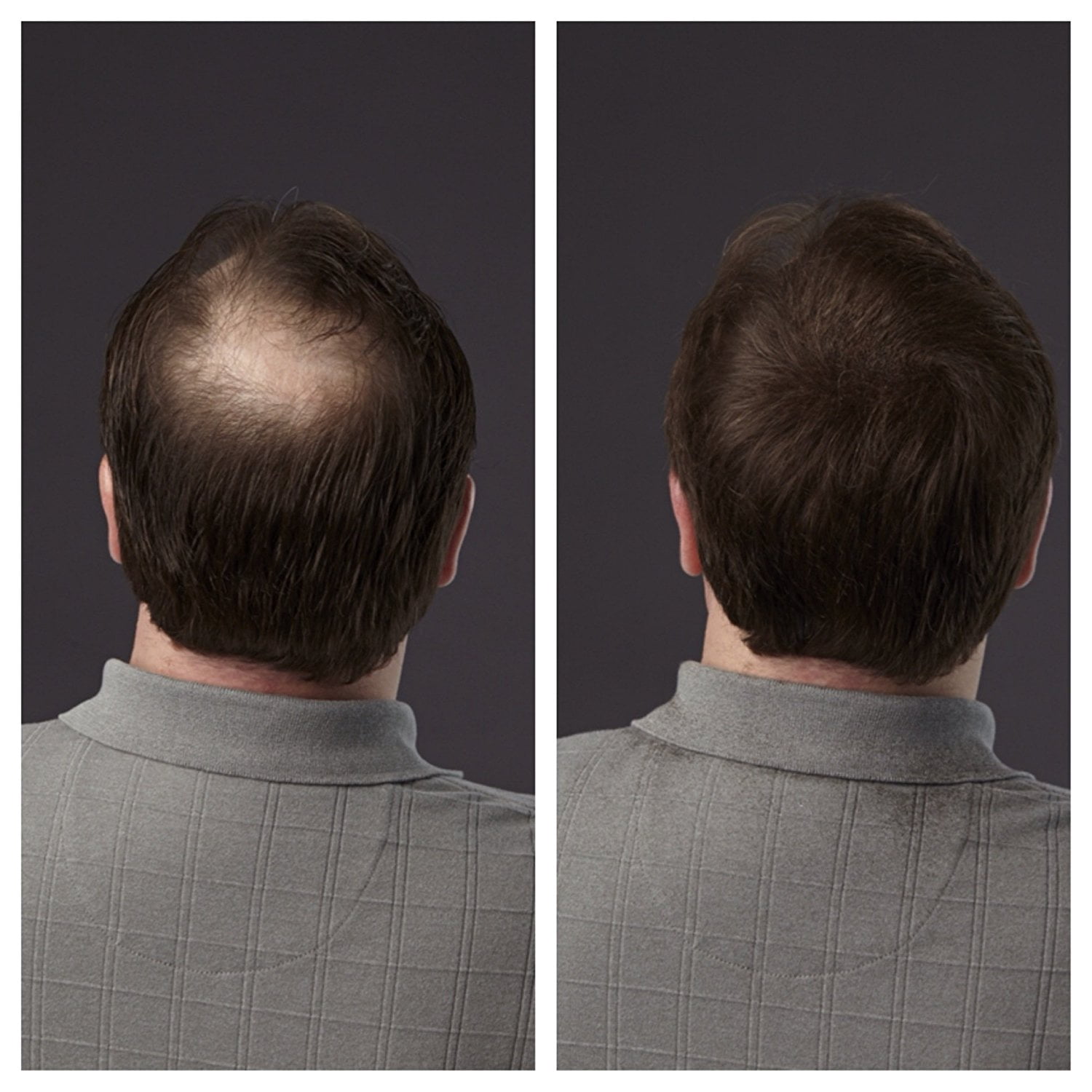 HAIR ILLUSION - 100% Real Human Hair Fibers - Not Synthetic - For Men & Women, Premium Hair Building Formulation, Brown - 38g