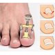 thumbnail image 1 of ZHAOCHENG Uñas encarnadas Manicura Pedicura Cuidado de los pies Herramienta correctora Cortador de dedos, 1 of 5
