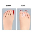 thumbnail image 4 of Hammer Toe Straightener Corrector for Overlapping Curled Toes Bunions Crooked, 4 of 9