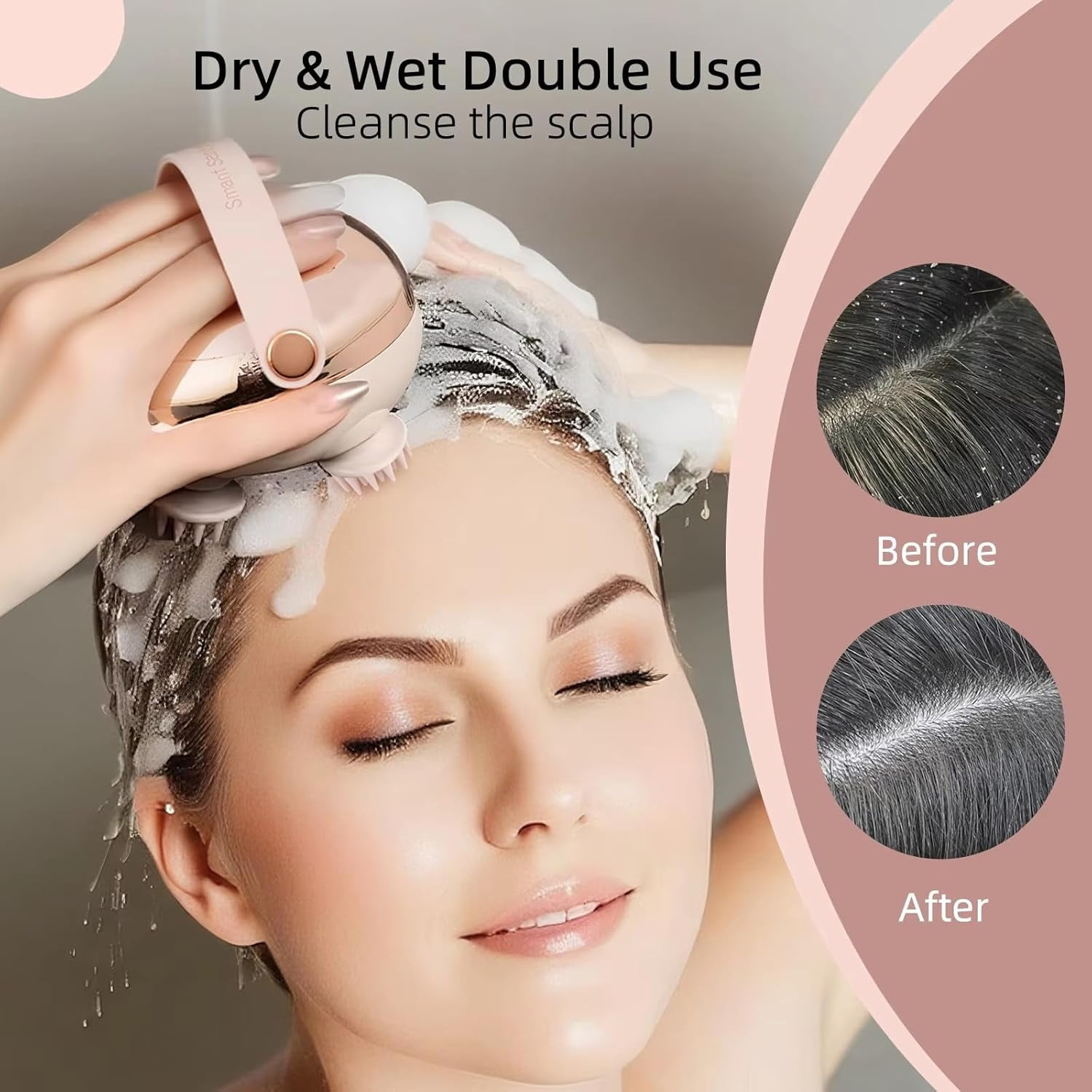 Handheld Electric Scalp Massager, Waterproof Head Scalp Scratcher, Dog Massage Tool, Electric Pet Cat Massager, Head Spa Portable