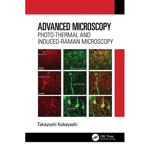 Advanced Microscopy: Photo-Thermal and Induced-Raman Microscopy, (Hardcover)