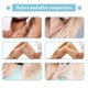 thumbnail image 5 of 1-3PCS Permanent Hair Removal Spray Painless Armpit Leg Arm Hair Remover Hair Growth Inhibitor Nourishing Repairing Body Care Men Women, 5 of 5