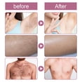 thumbnail image 6 of RYDCOT Gentle Hair Removal Cream for Smooth Skin - Qia Hair Removal Cream,Qia Hair Removal Cream For Men and Women,Whitening Hair Removal Cream 120g,Armpit Leg Hand Gentle Hair Removal, 6 of 6