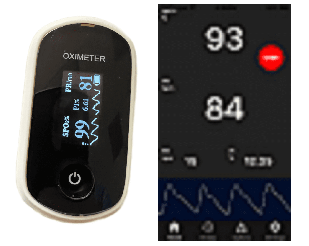 FDA approved Pulse Oximeter with App. Continuous measurement of vital