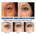 thumbnail image 5 of 100ml Collagen Anti Dark Circles Eye Cream, Anti-dark Circles Eye Cream Remove Eye Bag, 5 of 5