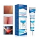 thumbnail image 5 of Clearance Sale! Men's Skin Care Yin Itch Thigh Inner Itch Relief Gentle Application Of Skin Regain Dryness And A Relaxed Feeling (Buy 2 get 1 free), 5 of 7
