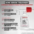 thumbnail image 2 of Sérum para el acné Thayers Double Action con 2% de ácido salicílico, 30 ml, 2 of 6