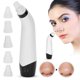 thumbnail image 5 of Aspirador de poros herramienta eléctrica de eliminación de puntos negros limpiador facial eléctrico para eliminación de limpieza de poros y puntos negros ANGGREK Otros, 5 of 8