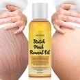 thumbnail image 2 of 1-3x Stretch Marks Remover Essential Oil, Organic Natural Stretch Marks Oil, Nourishing Body Oil For Stretch Marks Care, 2 of 5