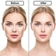 thumbnail image 5 of Parches de belleza antiarrugas de silicona para la frente, mejillas y barbilla, 16 unidades, mascarilla facial antiarrugas, herramienta de belleza para lifting facial., 5 of 5