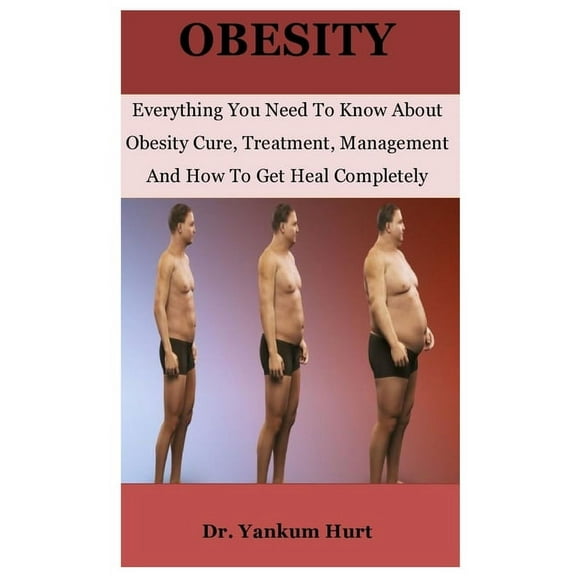 Obesity : Everything You Need To Know About Obesity Cure, Treatment, Management And How To Get Heal Completely (Paperback)