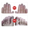 thumbnail image 4 of Neinkie Kit de Traitement de Correction d'Ongle Incarné Professionnel, Bandes de Correcteur d'Ongle Incarné Récupérer Clips avec la Lime et le Levage d'Ongle Incarné, 4 of 7