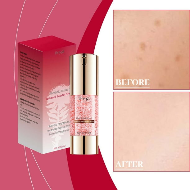 Lisbinx Spots Removing Cream Replenishes Moistures Tightens The