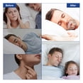 thumbnail image 4 of ELAIMEI Tiras Adhesivas para Cerrar la Boca ELAIMEI - Solución Anti Ronquidos para Dormir, 90 Piezas por Caja, Paquete de 2 Cajas, Ideal para un Sueño Tranquilo y Sin Interrupciones., 4 of 6