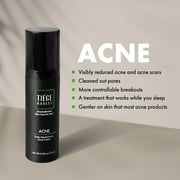 Tiege Hanley Mens ACNE Cream - 0.85 oz | Salicylic Acid 1.6% | Reduce Acne and Breakouts