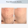 thumbnail image 3 of Sérum facial TOSOWOONG Niacinamida 15% con ácido tranexámico 30 ml, 3 of 6