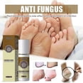 thumbnail image 4 of 3pcs Antibacterial Foot Spray - South Moon, Anti Itch, Sweat Odor Control, Exfoliating, Men Women, Anti-fungal Shoe, 4 of 5