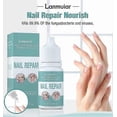 thumbnail image 2 of Fungal Nail Solution for Toenails - Fixes Discolored Nails, Safe & Effective - Anti Fungus Oil for Ingrown Toenails, 2 of 5